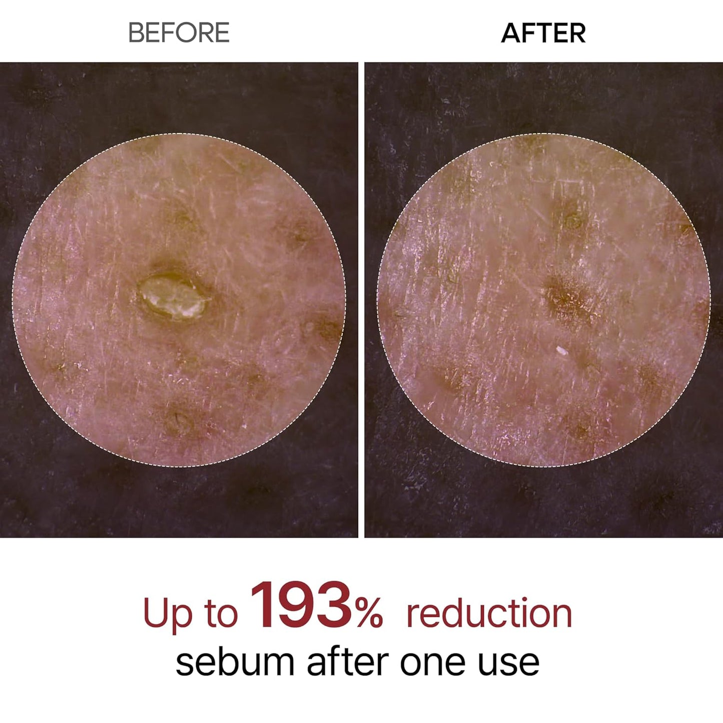 Dr. Melaxin Rice Exfoliating Essence Moisturizing Peel Shot White And Black Soften Serum Gentle Exfoliation Korean Skin Care