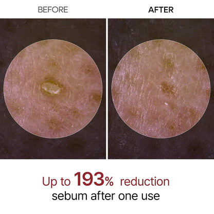 Dr. Melaxin Rice Exfoliating Essence Moisturizing Peel Shot White And Black Soften Serum Gentle Exfoliation Korean Skin Care